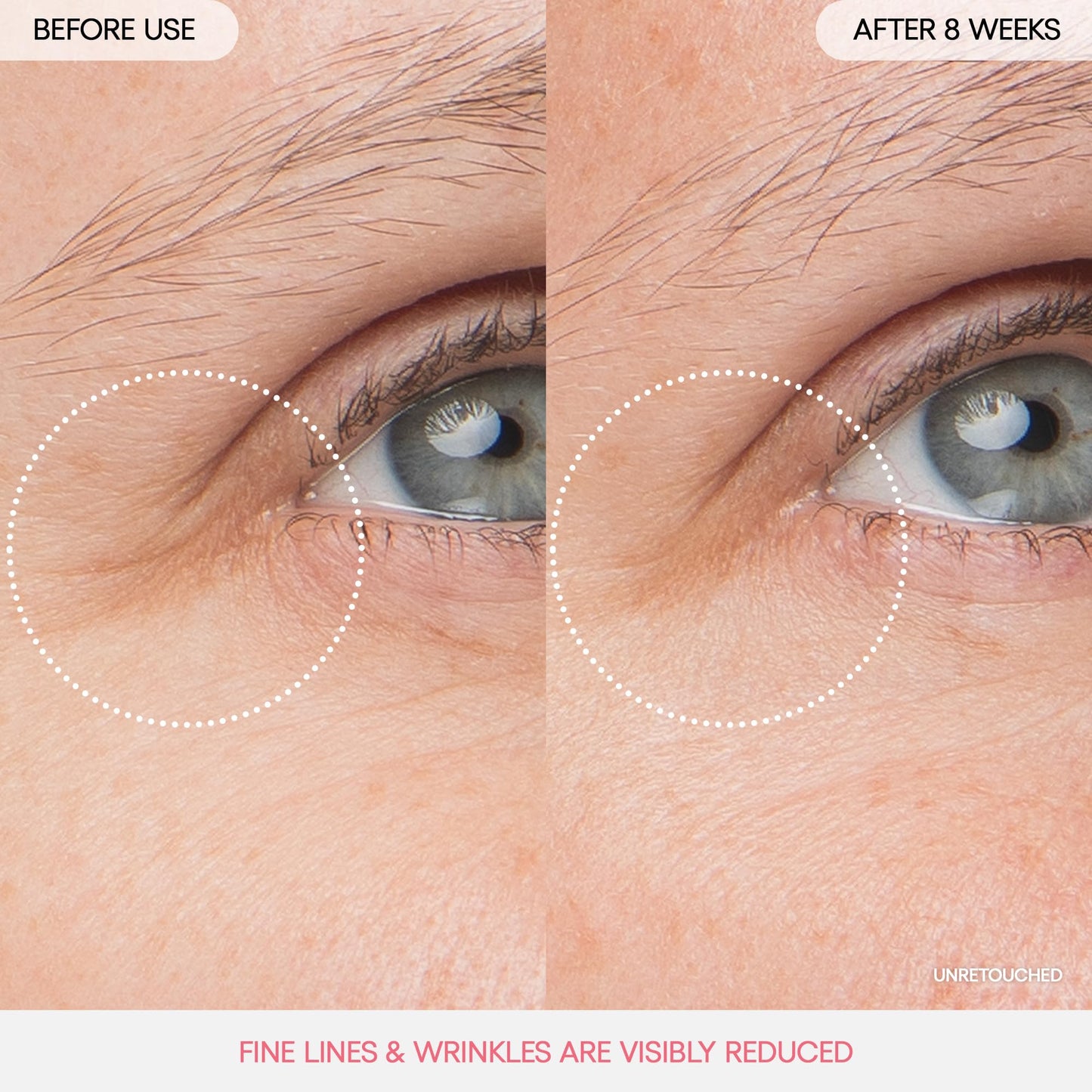 LANEIGE Lip Sleeping Mask: Nourish, Hydrate, Vitamin C, Murumuru & Shea Butter, Antioxidants, Flaky, Dry Lips